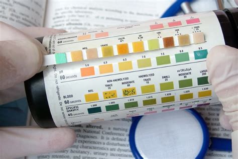 interpretation of urinalysis tests